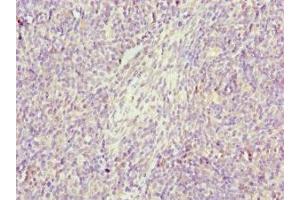Immunohistochemistry of paraffin-embedded human thymus tissue using ABIN7154419 at dilution of 1:100 (GZMH anticorps  (AA 20-246))