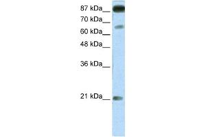 WB Suggested Anti-NFATC4 Antibody Titration:  1. (NFATC4 anticorps  (Middle Region))