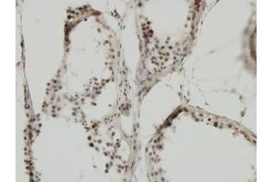 Image no. 5 for anti-Tripartite Motif Containing 24 (TRIM24) (AA 432-569) antibody (ABIN599067) (TRIM24 anticorps  (AA 432-569))