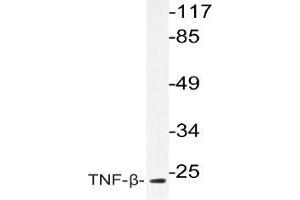 Western blot (WB) analysis of TNF-beta antibody in extracts from COS-7cells. (LTA anticorps)