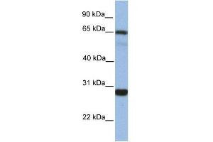 Western Blot showing MED4 antibody used at a concentration of 1.