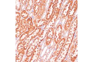 Immunohistochemistry of paraffin-embedded mouse kidney using Caspase-9 antibody (ABIN3016349, ABIN3016350, ABIN3016351 and ABIN6219728) at dilution of 1:100 (40x lens). (Caspase 9 anticorps)