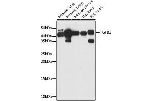 Western blot analysis of extracts of various cell lines, using TGFB2 antibody (ABIN1683015, ABIN3017925, ABIN3017926 and ABIN6220307) at 1:1000 dilution. (TGFB2 anticorps  (AA 20-160))