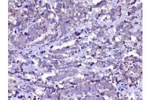 IHC analysis of Cdc20 using anti-Cdc20 antibody .