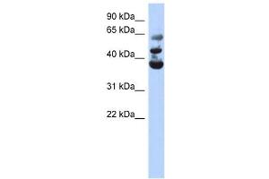 NSUN3 antibody used at 1 ug/ml to detect target protein. (NSUN3 anticorps  (Middle Region))