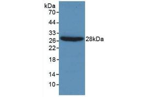 Detection of Recombinant Gelsolin, Human using Monoclonal Antibody to Gelsolin (GSN)