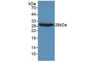 Detection of Recombinant Gelsolin, Human using Monoclonal Antibody to Gelsolin (GSN) (Gelsolin anticorps  (AA 432-553))