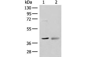 Western blot analysis of Mouse kidney tissue and Human fetal brain tissue lysates using ADH5 Polyclonal Antibody at dilution of 1:500