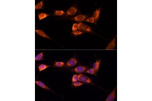 Immunofluorescence analysis of NIH-3T3 cells using TXNDC12 Polyclonal Antibody (ABIN7270800) at dilution of 1:100 (40x lens).