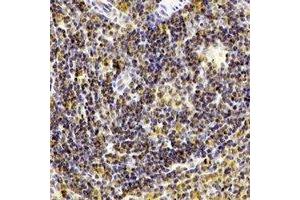 Immunohistochemical analysis of CD238 staining in human spleen formalin fixed paraffin embedded tissue section. (KEL anticorps)