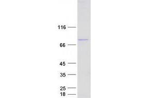 Validation with Western Blot