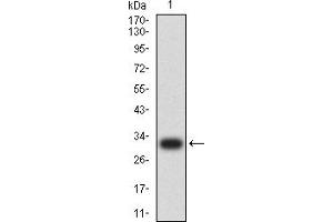 Western blot analysis using COL1A2 mAb against human COL1A2 (AA: 23-79) recombinant protein.