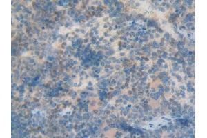 Used in DAB staining on fromalin fixed paraffin- embedded kidney tissue (KRT12 anticorps  (AA 398-456))