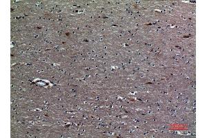 Immunohistochemistry (IHC) analysis of paraffin-embedded Human Brain, antibody was diluted at 1:100.