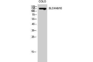 Western Blotting (WB) image for anti-Solute Carrier Family 4, Member 8/10 (SLC4A8/10) (Internal Region) antibody (ABIN3186974) (SLC4A8/10 anticorps  (Internal Region))
