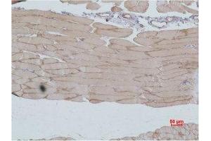 Immunohistochemistry (IHC) analysis of paraffin-embedded Mouse Skeletal MuscleTissue using IGFN1 Polyclonal Antibody. (IGFN1 anticorps)