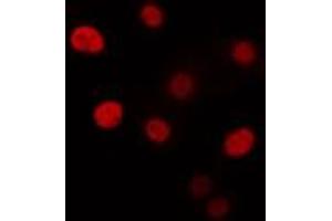 ABIN6274332 staining Hela cells by IF/ICC. (CHAF1B anticorps  (N-Term))