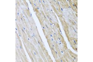 Immunohistochemistry of paraffin-embedded mouse heart using CAMK2G antibody at dilution of 1:100 (x40 lens). (CAMKII gamma anticorps)