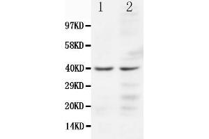 Anti-CCR5 antibody, Western blotting Lane 1: JURKAT Cell Lysate Lane 2: COLO320 Cell Lysate