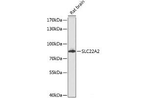 Western blot analysis of extracts of Rat brain using SLC22A2 Polyclonal Antibody at dilution of 1:1000. (SLC22A2 anticorps)
