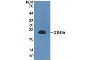 Detection of Recombinant CALML3, Human using Polyclonal Antibody to Calmodulin Like Protein 3 (CALML3) (CALML3 anticorps  (AA 1-149))