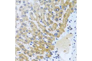 Immunohistochemistry of paraffin-embedded human liver using CP antibody (ABIN6129673, ABIN6138930, ABIN6138932 and ABIN6217722) at dilution of 1:100 (40x lens).