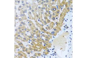 Immunohistochemistry of paraffin-embedded human liver using CP antibody (ABIN6129673, ABIN6138930, ABIN6138932 and ABIN6217722) at dilution of 1:100 (40x lens).