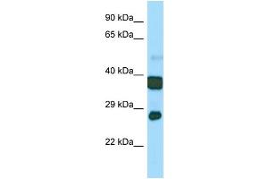 Host:  Rabbit  Target Name:  Atp5c1  Sample Type:  Mouse Stomach lysates  Antibody Dilution:  1.