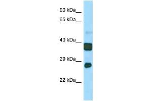 Host:  Rabbit  Target Name:  Atp5c1  Sample Type:  Mouse Stomach lysates  Antibody Dilution:  1. (ATP5C1 anticorps  (N-Term))