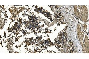 IHC analysis of RGS6 using anti-RGS6 antibody (ABIN7602326). (RGS6 anticorps  (AA 7-357))