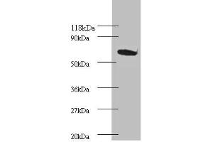 Western blot All lanes: Proteasome subunit beta type-4 Antibody at 2 μg/mL + EC109 whole cell lysate Secondary Goat polyclonal to rabbit IgG at 1/15000 dilution Predicted band size: 30 kDa Observed band size: 75 kDa (PSMB4 anticorps  (AA 46-264))