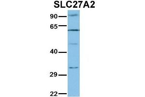 WB Suggested Anti-SLC27A2 Antibody Titration:  1 ug/ml  Positive Control:  Jurkat lysate (SLC27A2 anticorps  (N-Term))