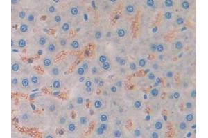 Used in DAB staining on fromalin fixed paraffin- embedded liver tissue