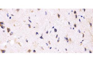 Immunohistochemistry of paraffin-embedded Rat brain using PPP2R4 Polyclonal Antibody at dilution of 1:200 (40x lens). (PPP2R4 anticorps)