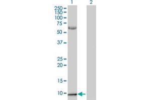 Lane 1: S100A2 transfected lysate ( 10.