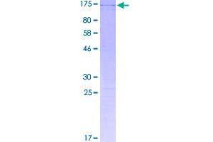 Image no. 1 for TSPY-Like 2 (TSPYL2) (AA 1-693) protein (GST tag) (ABIN1323960)