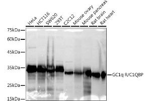 Western blot analysis of extracts of various cell lines, using GC1q R/C1QBP antibody (ABIN7266473) at 1:1000 dilution.
