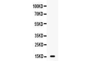 Western blot analysis of GIP expression in MCF-7 whole cell lysates ( Lane 1). (GIP anticorps  (AA 52-93))