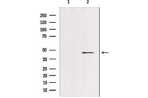 Western blot analysis of extracts from c476, using FOXN2 Antibody.