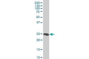 HMGB2 monoclonal antibody (M03), clone 3C7 Western Blot analysis of HMGB2 expression in Hela S3 NE . (HMGB2 anticorps  (AA 1-195))