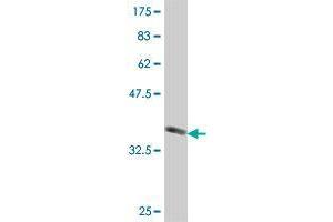 Western Blot detection against Immunogen (37.