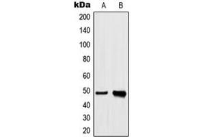 Western blot analysis of hnRNP H expression in A549 (A), HeLa (B) whole cell lysates. (HNRNPH1 anticorps  (Center))
