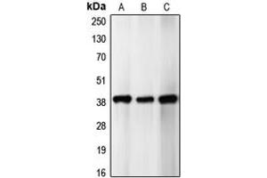 Western blot analysis of p39 expression in SHSY5Y (A), HeLa (B), U87MG (C) whole cell lysates. (p39 (Center) anticorps)