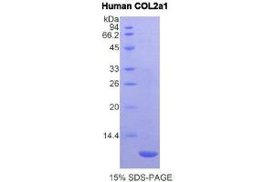 SDS-PAGE (SDS) image for Collagen, Type II, alpha 1 (COL2A1) (AA 1386-1467) protein (His tag) (ABIN1878250) (COL2A1 Protein (AA 1386-1467) (His tag))