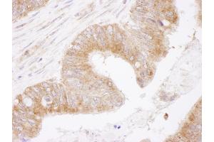 Immunohistochemistry (IHC) image for anti-B-Cell CLL/lymphoma 2 (BCL2) (AA 50-100) antibody (ABIN7454495) (Bcl-2 anticorps  (AA 50-100))