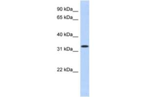 Western Blotting (WB) image for anti-metallophosphoesterase Domain Containing 2 (MPPED2) antibody (ABIN2463910) (MPPED2 anticorps)