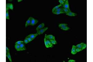 Immunofluorescent analysis of HepG2 cells using ABIN7172274 at dilution of 1:100 and Alexa Fluor 488-congugated AffiniPure Goat Anti-Rabbit IgG(H+L)