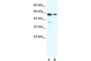 WB Suggested Anti-G22P1 Antibody Titration:  0. (XRCC6 anticorps  (N-Term))