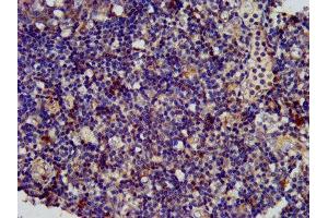 IHC image of ABIN7168933 diluted at 1:400 and staining in paraffin-embedded human tonsil tissue performed on a Leica BondTM system. (SPINK6 anticorps  (AA 24-80))