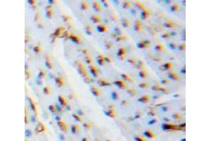 Used in DAB staining on fromalin fixed paraffin-embedded Heart tissue (LGALS1/Galectin 1 anticorps  (AA 1-135))